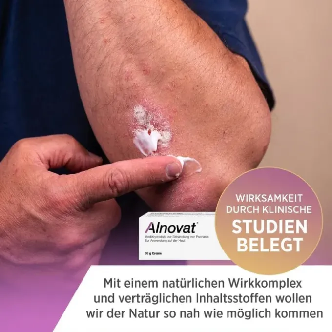 ALNOVAT Creme 50 g