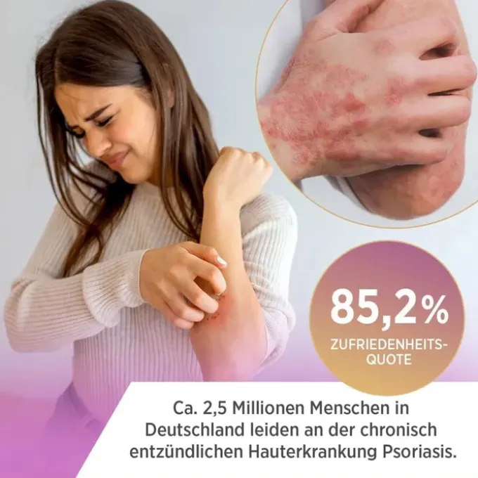 ALNOVAT Creme 50 g