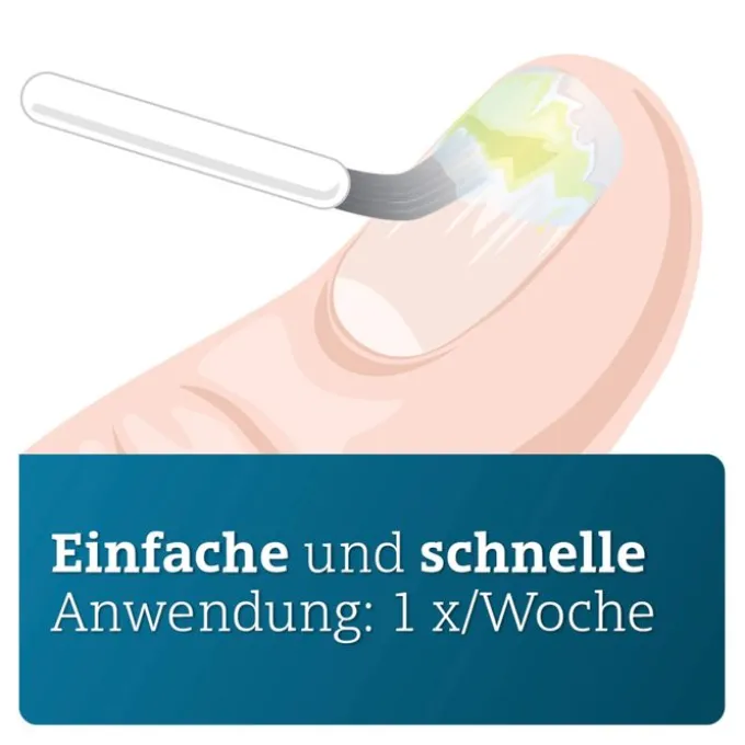 AMOROLFIN ADGC 50 mg/ml wirkstoffhalt.Nagellack 5 ml