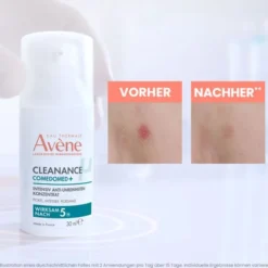 AVENE Cleanance Comedomed Anti-Unreinheiten Konz. 30 ml
