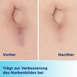 BEPANCARE Narben-Gel 20 ml