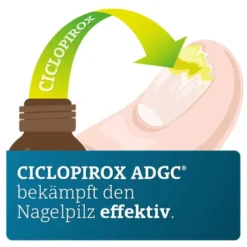 CICLOPIROX ADGC 80 mg/g wirkstoffhalt.Nagellack 3,3 ml