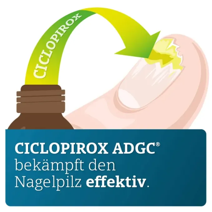 CICLOPIROX ADGC 80 mg/g wirkstoffhalt.Nagellack 3,3 ml