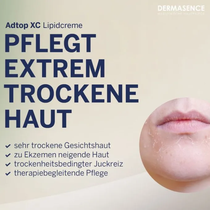 DERMASENCE Adtop XC Lipidcreme 50 ml