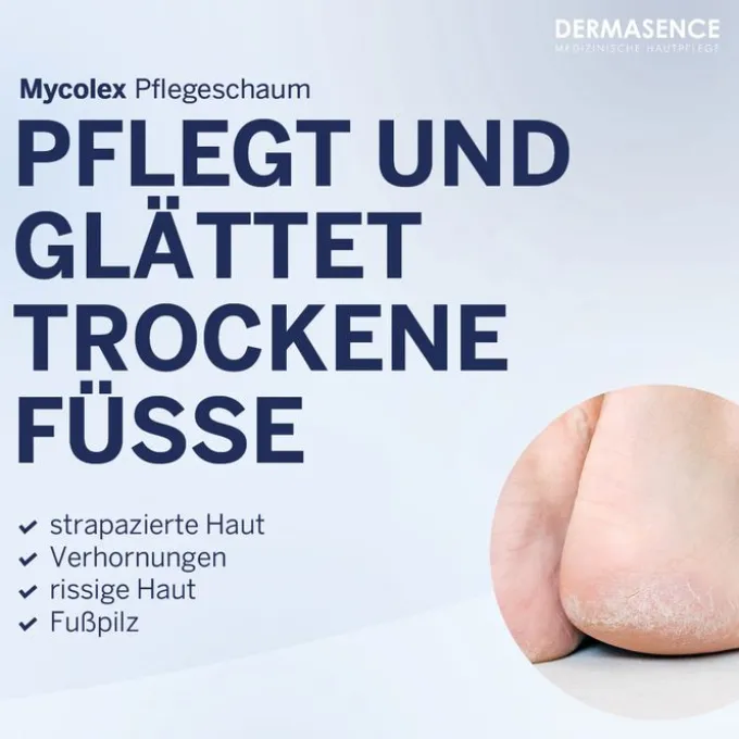 DERMASENCE Mycolex Pflegeschaum 125 ml