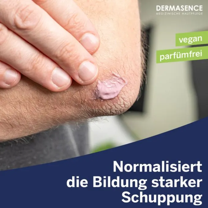 DERMASENCE Vitop Psoricur Akutpflegecreme 100 ml