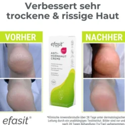 EFASIT Anti-Hornhaut Creme 75 ml