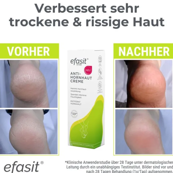 EFASIT Anti-Hornhaut Creme 75 ml