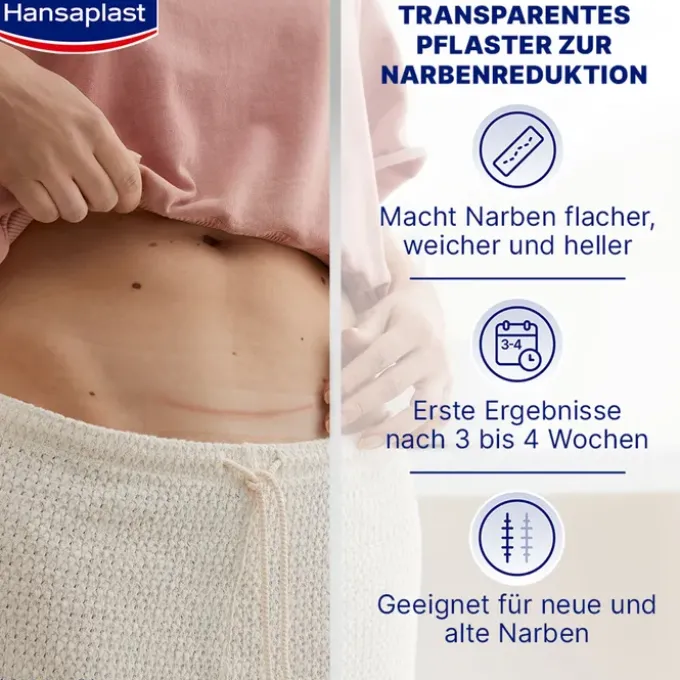 HANSAPLAST Pflaster zur Behandlung von Narben XL 21 St