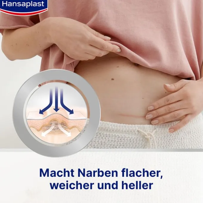 HANSAPLAST Pflaster zur Behandlung von Narben XL 21 St