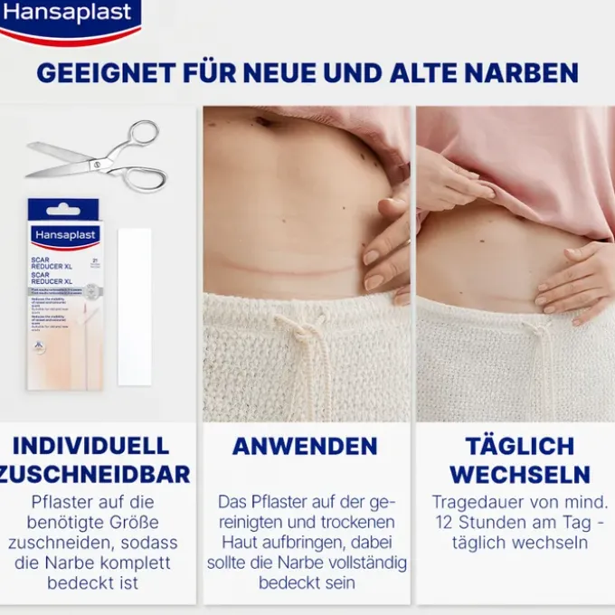 HANSAPLAST Pflaster zur Behandlung von Narben XL 21 St