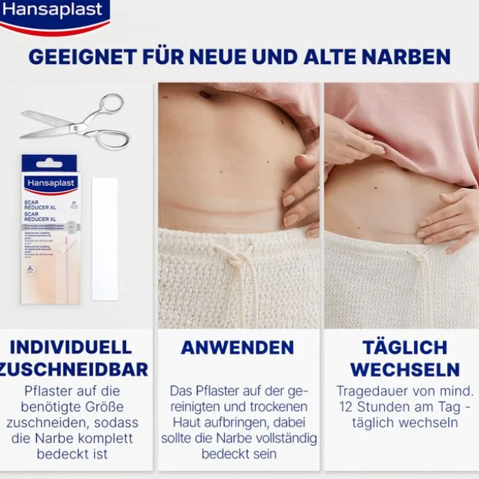 HANSAPLAST Pflaster zur Behandlung von Narben 21 St