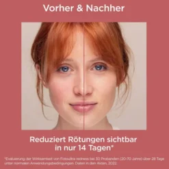 ISDIN FotoUltra Redness Creme LSF 50 50 ml