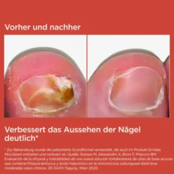 ISDIN Si-Nails MICOXPERT MD Stift 4,5 ml