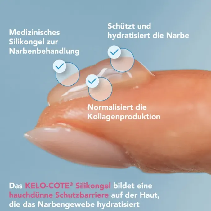 KELO-COTE Kids Silikon Narbengel 6 g