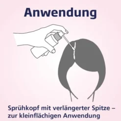 MINOXICUTAN Frauen 20 mg/ml Spray 180 ml