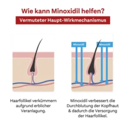 MINOXIDIL DoppelherzPhar.50mg/ml Lsg.Anw.Haut Mann 180 ml