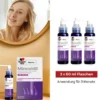 MINOXIDIL DoppelherzPhar.20mg/ml Lsg.Anw.Haut Frau 180 ml