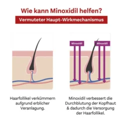 MINOXIDIL DoppelherzPhar.20mg/ml Lsg.Anw.Haut Frau 180 ml