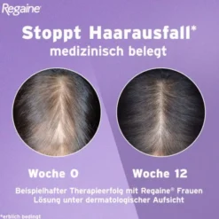 REGAINE® Frauen Lösung mit 2% Minoxidil 180 ml