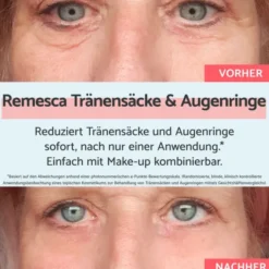 REMESCAR Tränensäcke und Augenringe Augencreme 8 ml