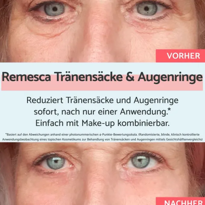 REMESCAR Tränensäcke und Augenringe Augencreme 8 ml