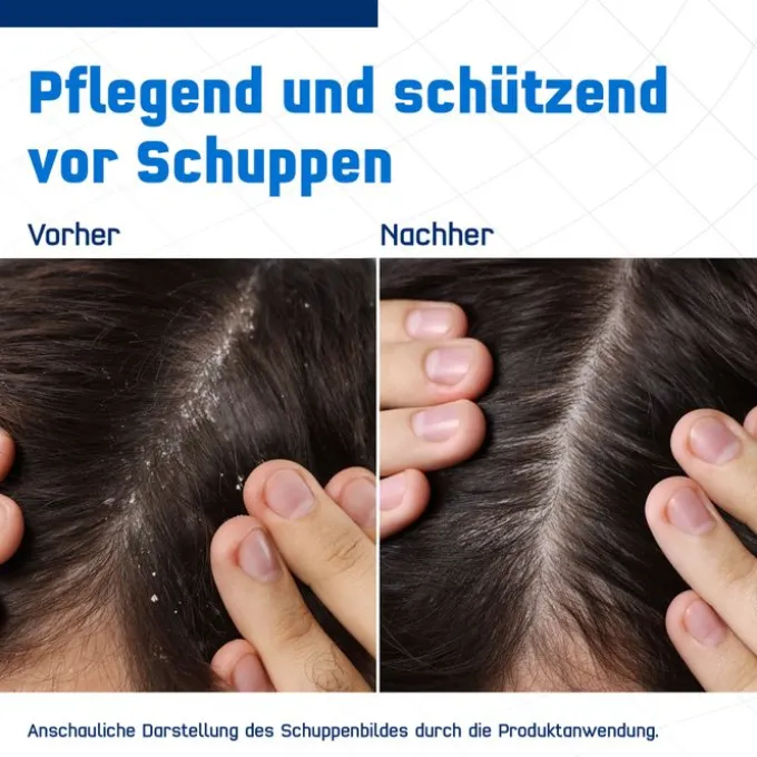 TERZOLIN Expert Shampoo bei fettiger Kopfhaut 200 ml