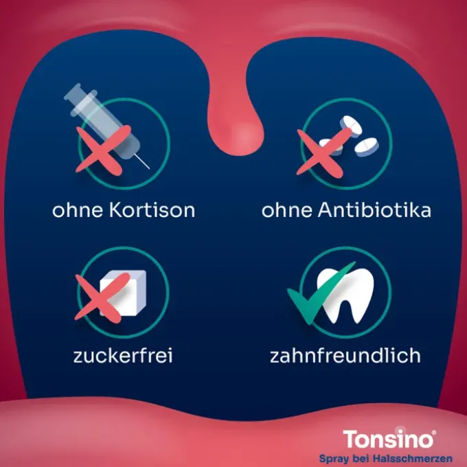 TONSINO Spray b.Hals.1,5mg/ml Spr.z.Anw.i.d.Mundhö 30 ml