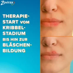 ZOVIRAX Lippenherpes Creme 2 g